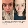 UpCircle Sensitive Skin Set - Image 2