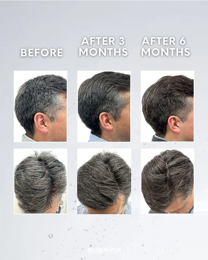 Anti Graying Lotion - Image 2